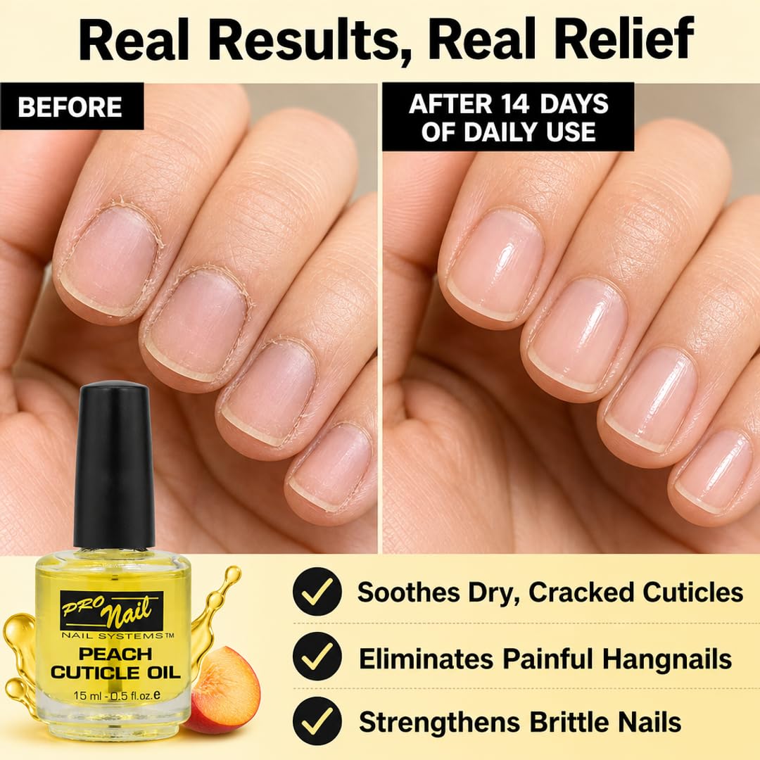 Amazon.com: PRO NAIL Cuticle Oil – 6-Oil Botanical Blend with